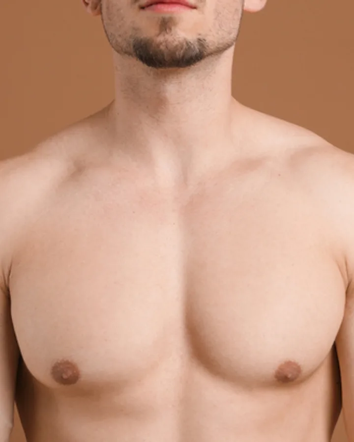 Göğüs — after OMEGA laser hair removal