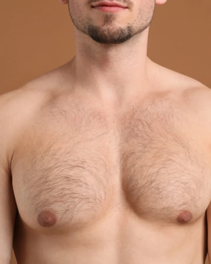 Göğüs — before treatment