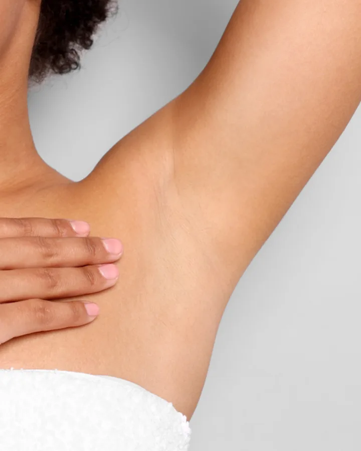 Koltuk Altı — after OMEGA laser hair removal